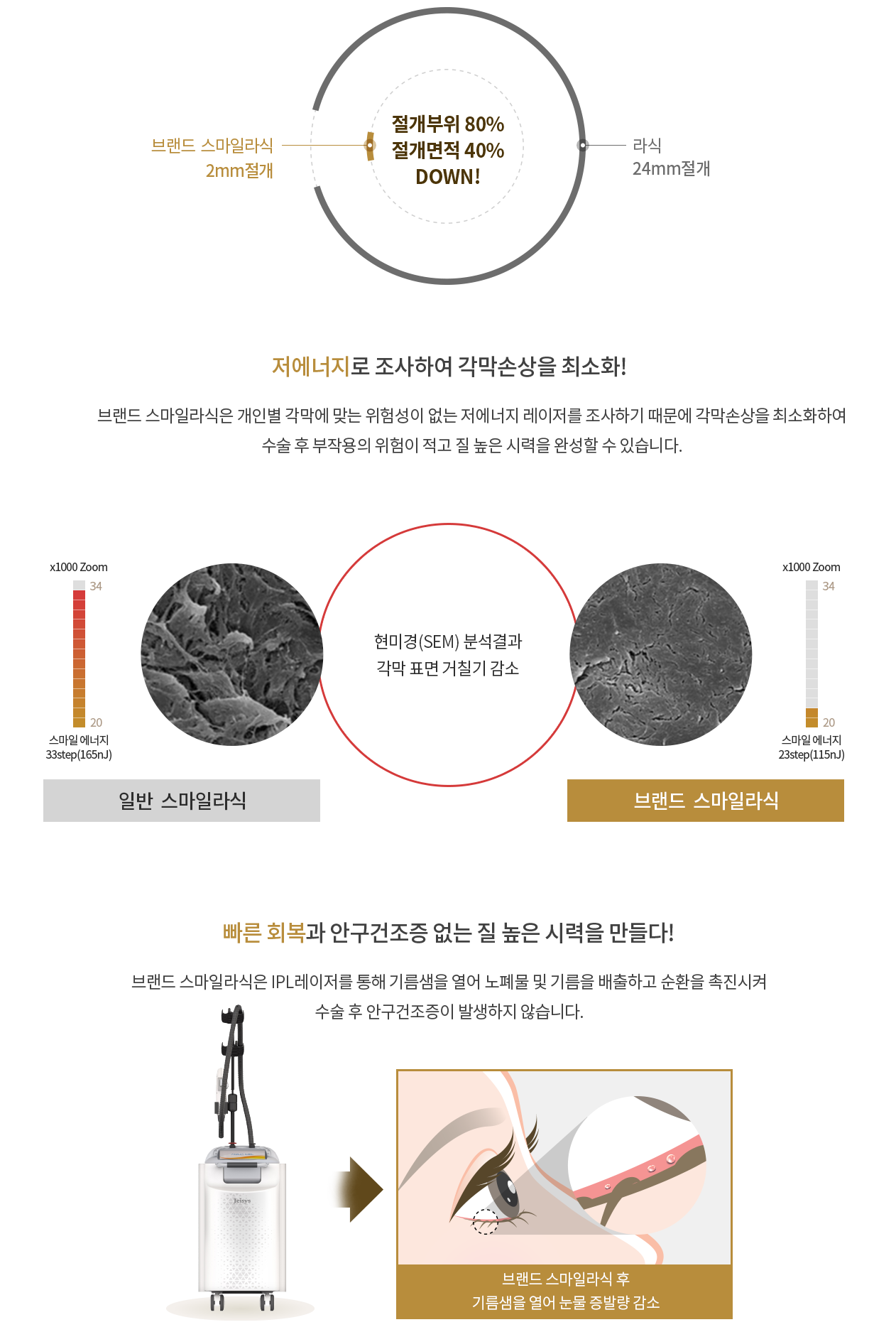 강남브랜드안과 - 올레이저노안백내장수술의 '기준이 되다.'