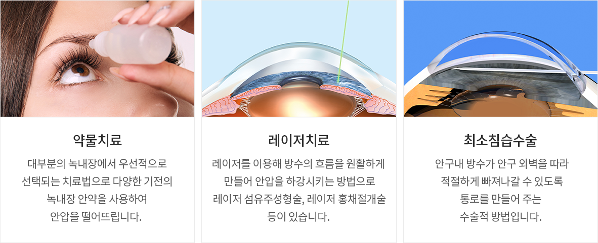 강남녹내장의 조기발견과 치료가 중요한 이유